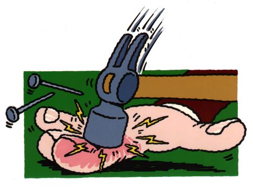 Hand being hit with a hammer.