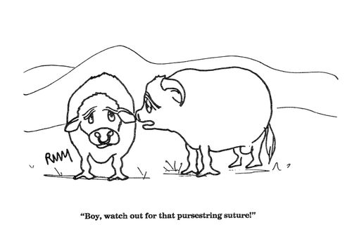 'Boy, watch out for that pursestring suture!'