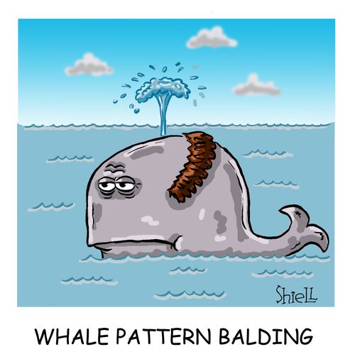 Whale Pattern Balding,