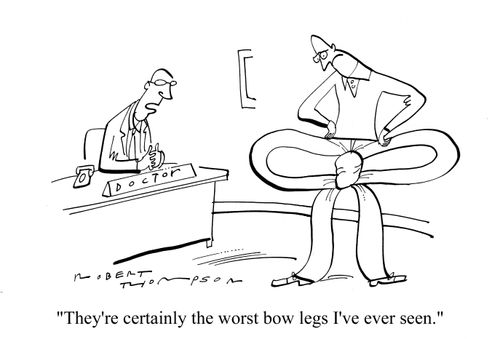 'They're certainly the worst bow legs I've ever seen.'