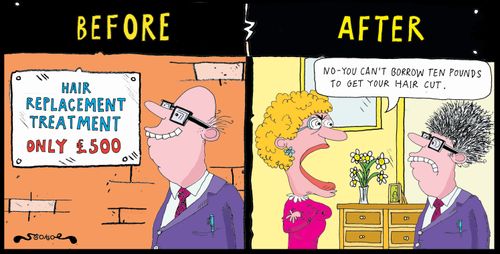 'Before and after a hair replacement treatment.'