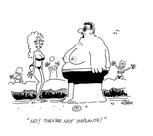 'No!  They're not implants!'