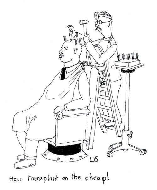 Hair transplant on the cheap!
