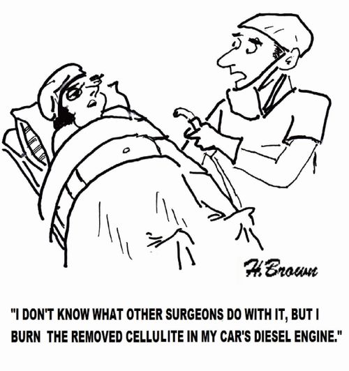 'I don't know what other surgeons do with it, but I burn the removed cellulite in my car's diesel engine.'