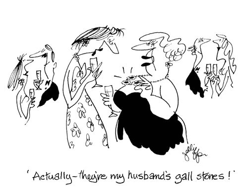 Women admiring a necklace: 'Actually - they're my husband's gall stones!'