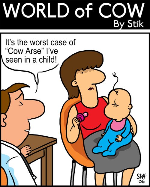 That's the worst case of 'cow arse' I've seen in a child!