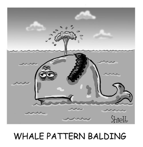 Whale Pattern Balding