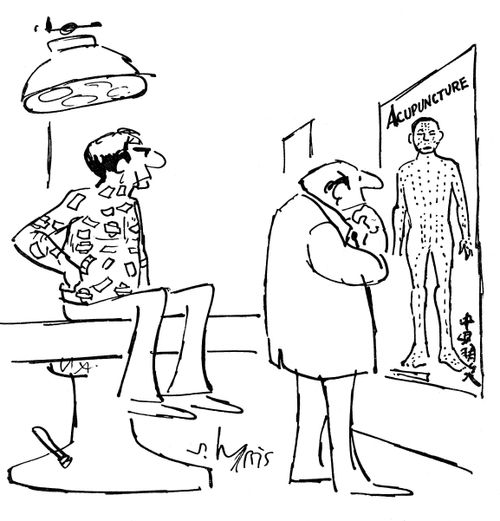 Acupuncture.