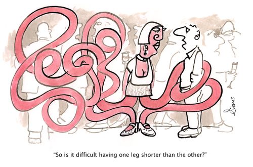 "So is it difficult having one leg shorter than the other?"
