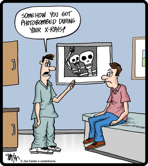 'Somehow you got photobombed during your x-rays!'
