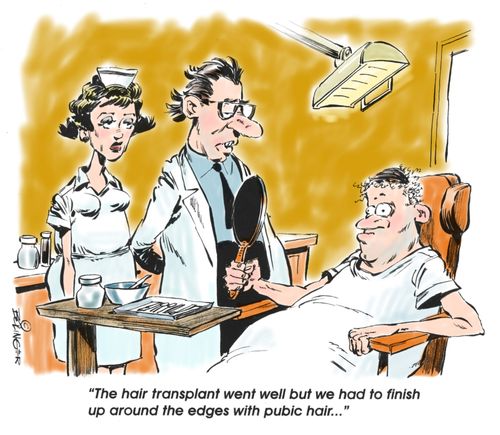 'The hair transplant went well but we had to finish up around the edges with pubic hair...'