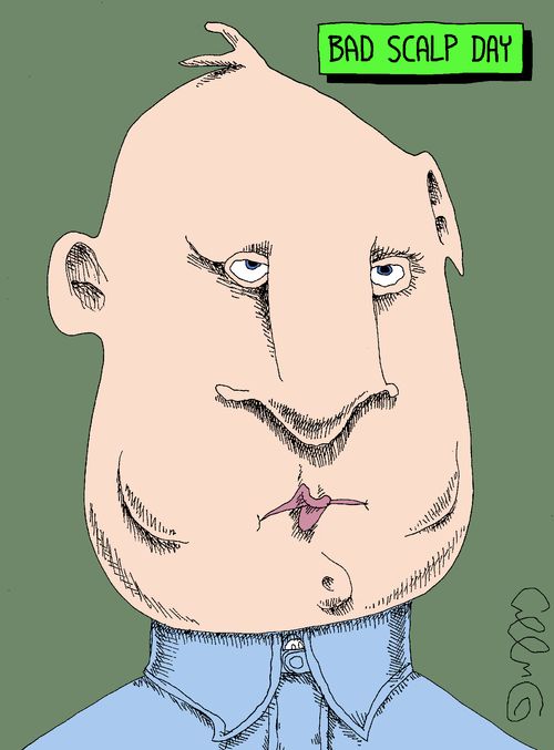 Bad Scalp Day