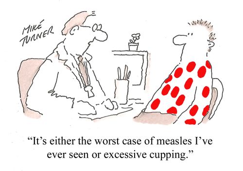 "It's either the worst case of measles I've ever seen or excessive cupping."