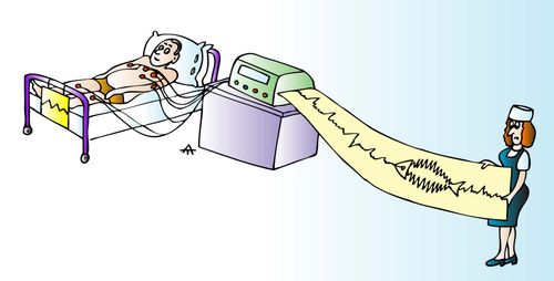 A patient's heart monitor reveals he is thinking about fish.