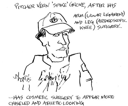 Pitcher Vern 'Spike' Grove, after his arm and leg surgery has cosmetic surgery to appear more chiseled and athletic-looking.