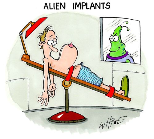Alien implants