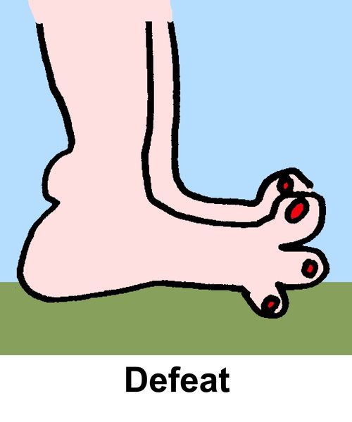 Defeat