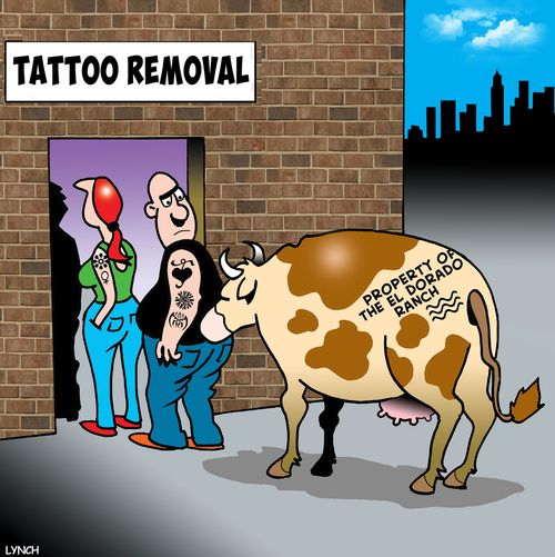 Tattoo Removal