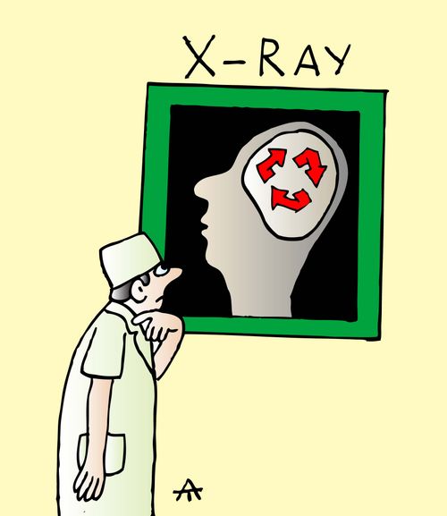 X-RAY
