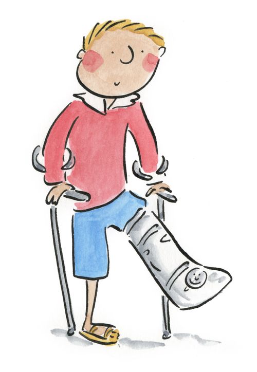 Broken Leg