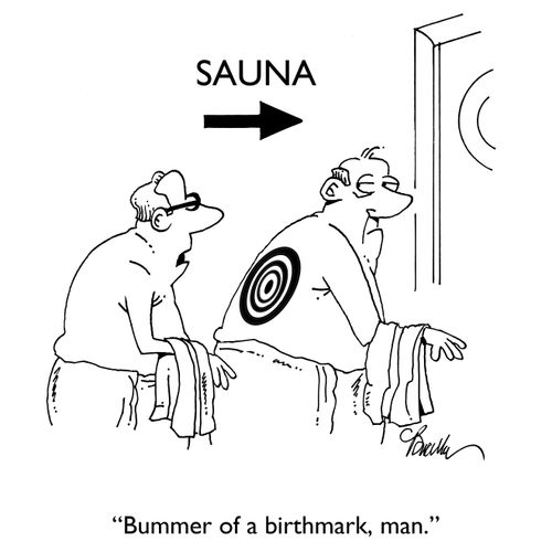 "Bummer of a birthmark, man."
