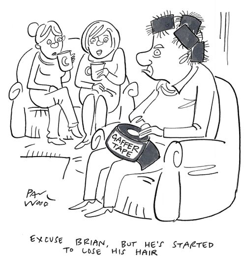 "Excuse Brian, but he's started to lose his hair."