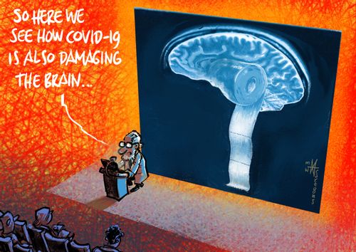 "So here we see how Covid-19 is also damaging the brain."