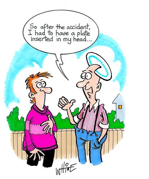 "So after the accident, I had to have a plate inserted in my head. . ."