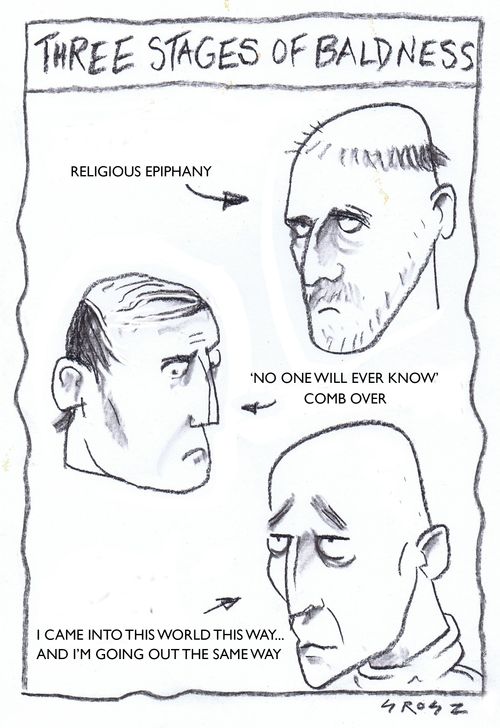 The three stages of baldness