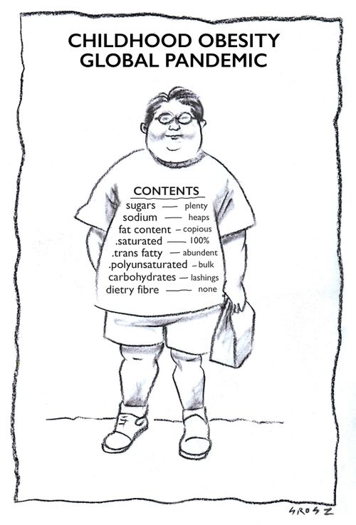 Childhood obesity global pandemic