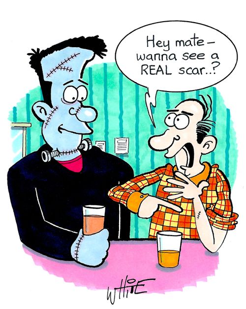 "Hey mate - wanna see a REAL scar..?"