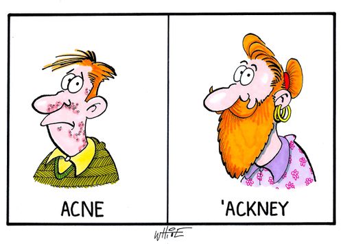 acne / ' ackney...