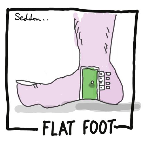 Flat Foot