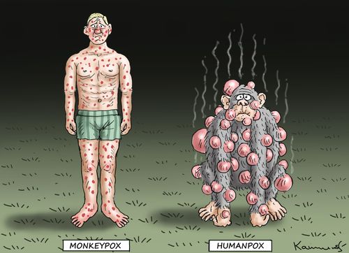 Monkeypox/Humanpox