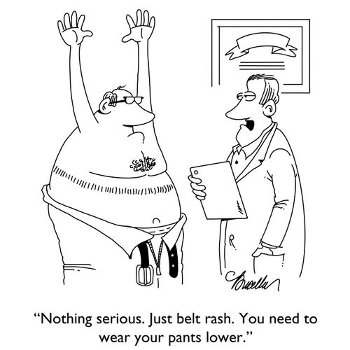  "Nothing serious. Just belt rash. You need to wear your pants lower."