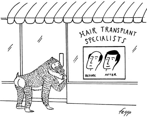Hair Transplant Specialists