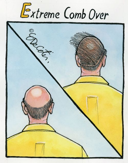 Extreme Comb Over