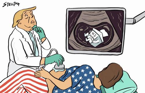 Trump's conflicting abortion stances.