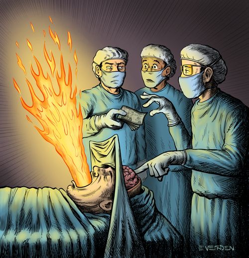 Fire Brain